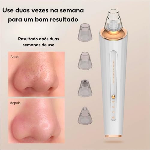 Removedor De Cravos, Espinhas, Sugador Poros Acne Sucção Recarregável