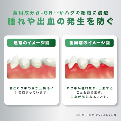 GUM(ガム) 歯周プロケア 歯周病予防 ハグキケア 薬用ハミガキ 歯磨き粉 デンタルペースト レギュラータイプ メディカルミントタイプ の商品画像 5