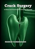 Crack Surgery: A Clinical and Visual Guideline for Crack Dissection