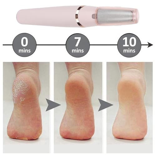 Lotvic Hornhautentferner Elektrisch, Elektrischer Hornhautentferner, 2 in 1 Fußpflege Elektrisch, Pediküre Set, Hornhaut Entfernen Fuß für Tote, Harten, Rissige Haut, Roségold