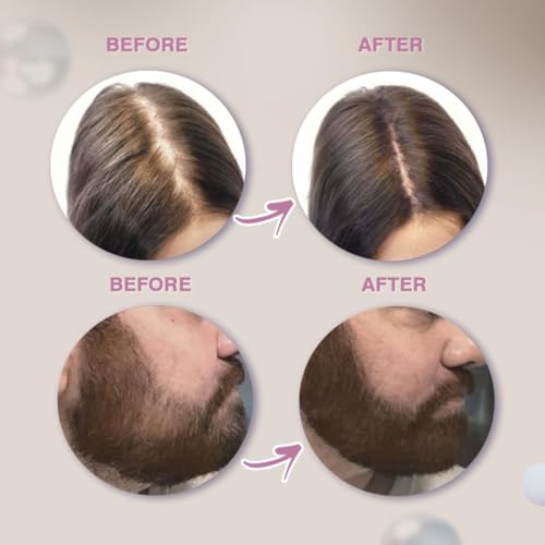 Image of Glamveda Cover-Up Hair Powder - Brown | Covers Grey Roots & Bald Spots Instantly | Root Touch Up | Highly Pigmented, Fuller & Denser Look | Long-Lasting | Matte Finish | Fine Powder | Natural Look 4g
