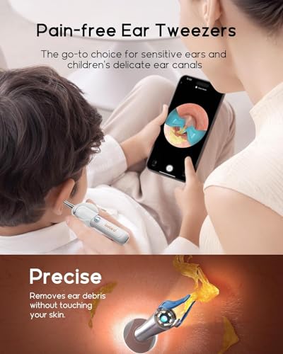 Image of Bebird Earsight Plus R37R Ear Wax Removal Tool Camera, FSA HSA Eligible Items, Smart Ear Cleaner with Painless Visual Tweezers, Flexible Ear Camera Otoscope, Home ENT Cleaning Kit for Family,White