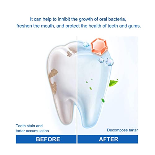 New Propolis Teethregrowth Dental Gel, Teethregrowth Dental Gel, Natural Whitening Toothpaste, Tooth Whitening Gel, Oral Gel For Healthy Teeth And Gums, Freshens Breath & Improves Oral Health (1Pc) #TOP2