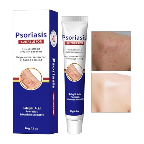 Crema Calmante para el Cuidado de la Piel -, Absorción Rápida, Nutritiva - Loción Corporal De Cuidado De La Piel,Para Hombres y Mujeres, Cuerpo, Reduce las Molestias y Tirantez, Aspecto