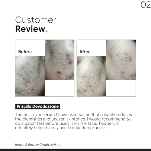 Image of Minimalist AHA BHA PHA 25% Peeling Solution + 10% Niacinamide Serum with Zinc Mini Combo | Acne Marks Removal, Oil Control, Pore Minimizing & Skin Brightening Combo for Oily & Acne-Prone Skin