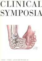 Traumatic Disorders of the Ankle and Foot B0007EJ93I Book Cover