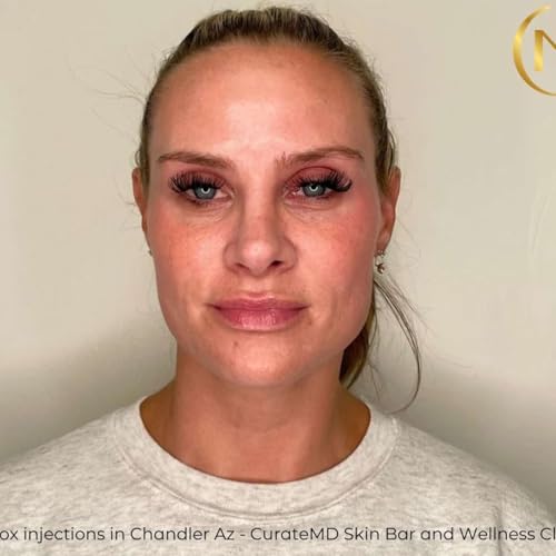 Botox injections in Chandler Az - CurateMD Skin Bar and Wellness Clinic