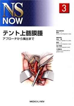 テント上髄膜腫 アプロ-チから摘出まで  /メジカルビュ-社/新井一（単行本） テント上髄膜腫−アプローチから摘出まで (NS NOW No.3) | 新井