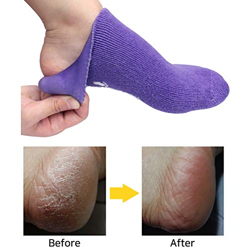 Comfort Gel Socks For Men And Women - Soft Spa Silicone Gel Infused Moisturizing Socks (Purple (1 Pair)) #TOP4