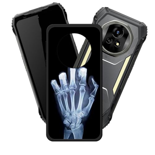 LCEHTOGYE �K�p Blackview Xplore 2�p�P�[�X�A�K�p Blackview Xplore 2 (6,73")�ƌ݊����̂��钴���^�u���b�N�\�t�gTPU�V���R���Q���P�[�X�ی�J�o�[- LH4