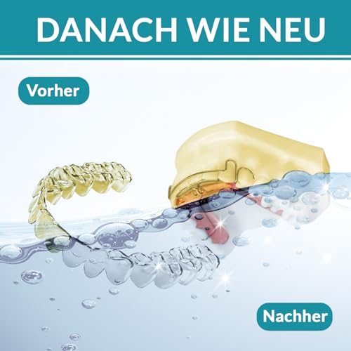 Zahnspangenreiniger von Perfekt-Schlafen24 für Retainer und Zahnschienen