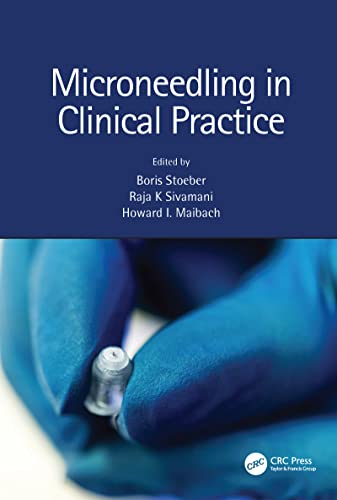 Microneedling in Clinical Practice view 2