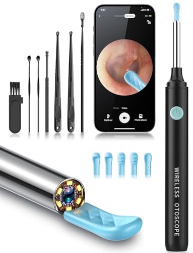 Ohrenschmalz Entfernung Kit - Ohrreiniger mit Kamera, Otoskopkamera mit 6 Silikon-Ohrlöffel mit 1080P, Ohrkamera mit LED-Licht, Ohrreinigungsset für iPhone, iPad, Android - Schwarz Ohrenschmalz Entfernung Kit - Ohrreiniger mit Kamera, Otoskopkamera mit 6 Silikon-Ohrlöffel mit 1080P, Ohrkamera mit LED-Licht, Ohrreinigungsset für iPhone, iPad, Android - Schwarz