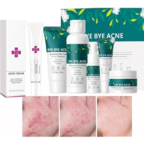 Acne Treatment for Face Skin Care Sets & Kits and Acne Cream Pimple Cream for Face Cover