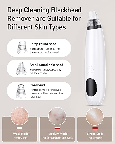 Bebird Pro Ear Wax Removal Tool With 1440P Hd Camera And 6 Led Lights, Free With Deep Cleaning Blackhead Remover, Ear Cleaner For Smaller Ears,Fda Ear Wax Removal Kit For Ios,Android Phones Pink #TOP5