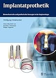 Implantatprothetik: Biomechanische und prothetische Konzepte in der Implantologie
