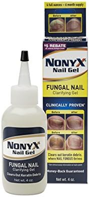 Nonyx Nail Gel, 4.0 OZ (2 Pack)