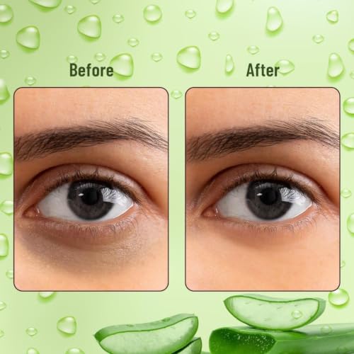 Image of Green Tea Hydrogel Under Eye Patches for Dark Circle, Fine Lines & Wrinkles Reduction | Cooling Under Eye Patch Mask for Instant De-Puffing (Eye Patches)