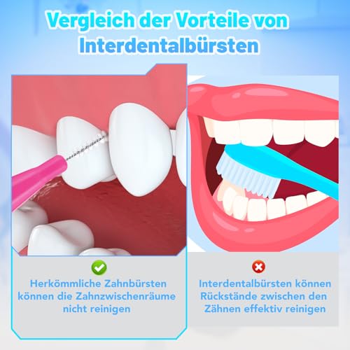 50 Stück Interdentalbürsten, Weiche Zahnzwischenraumbürsten in 6 Größen Dentalbürsten für Zahnreinigung Zwischenräume Zahnspangen Mundreinigung (10 Farben)