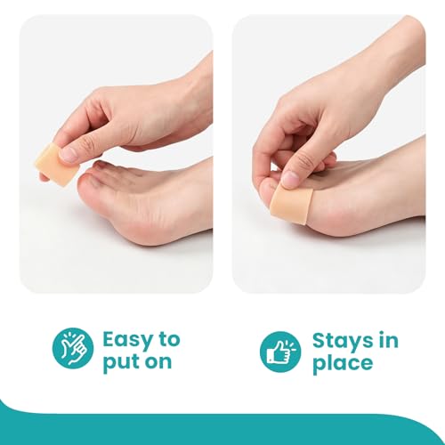 Image of Silicone Toe Protectors - 12 Pack Silicone Toe Sleeve for Hammer Toes, Corns, Calluses, Blisters - Soft Gel Toe Tube Pads for Pain Relief(Large Sizes, Beige)