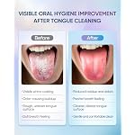 BodyAccel Tongue Cleaner Gel with Tongue Brush – Fresh Breath Oral Care Kit – Tongue Scraper Gel Set for Bad Breath Removal, Maintain Oral Health - Image 4