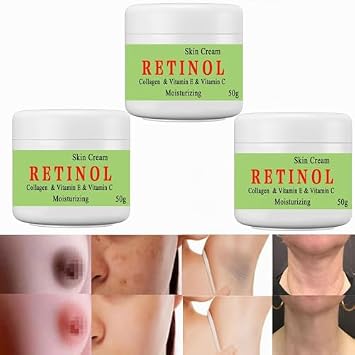 Cremas Para Las Manchas de La Cara, 50g Vitamin C&E Face Moisturizer Cream, Adecuado para varias areas como cara, axilas, cuello, zona privade (3pcs)