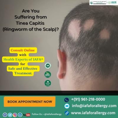 Ayurvedic Treatment of Alopecia