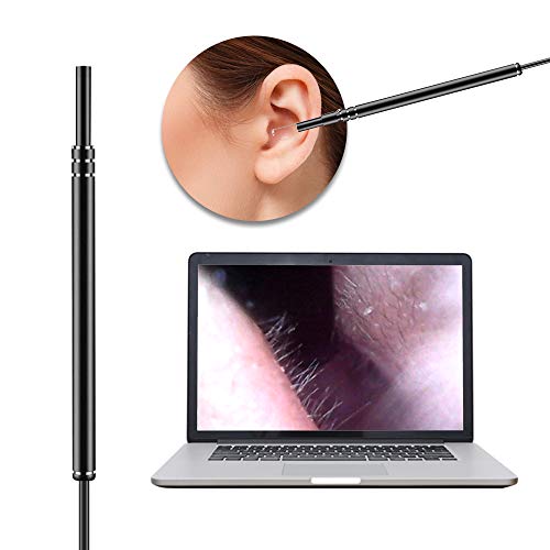 Câmera Endoscopia Limpeza Ouvido Melhoria Audição Alcance Áreas Profundas Boca Cabelo Nariz Prático