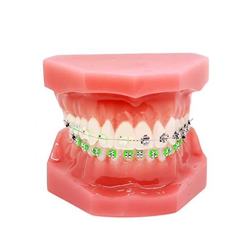 Orthodontic Model, YOUYA DENTAL 1/4 Metal self-Locking Comparison Orthodontic Model Orthodontic Tooth Model Dental Teaching Teeth Model with Metal Braces Bracket for Dentist Teaching Tools to Display