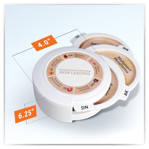 Image of GPI Anatomicals Skin Cancer Model with Precancerous & Cancerous Skin Lesion
