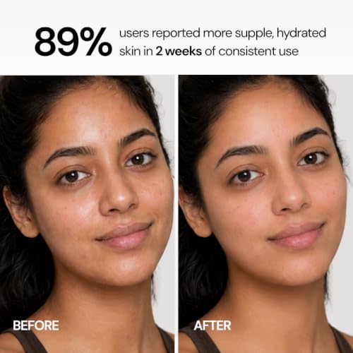 Image of Gentle Daily Face Cleanser, Soap-Free pH-Balanced Face Wash with Multi-Fruit AHA, Aloe Vera, Alpha-Arbutin, Allantoin & Panthenol | For Normal, Oily, Combination & Sensitive Skin | Sulphate Free Cleanser for Men, Women, Boys, Girls & Teens | 200ml | Clarity Labs