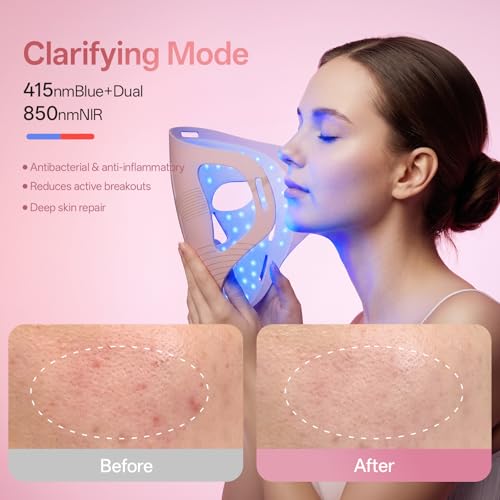 Image of Red Light Therapy for Face & Jawline-FDA Cleared 4D Face Mask with 324 LEDs,6 Modes (Red /Blue /Infrared) |Cordless for Home & Travel | Skincare Gifts for Women- Anti Aging LED Mask-Firm,Glowing Skin