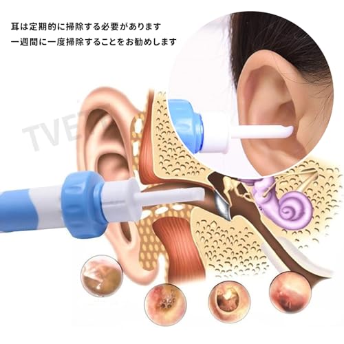 TVETE 耳掃除 【1セット】耳掃除 吸引 耳掃除 吸引 強力 耳掃除 吸引 カメラ付き 耳かき 吸引 強力 電動イヤークリーナー 耳垢 吸引 耳掃除 吸引 ごっそり取る イヤークリーナー 人間 吸引 耳クリーナー 吸引 強力 耳垢 吸引 振動 吸引式 子供、大人、中年、高齢者に適しています（電池は付属しません）