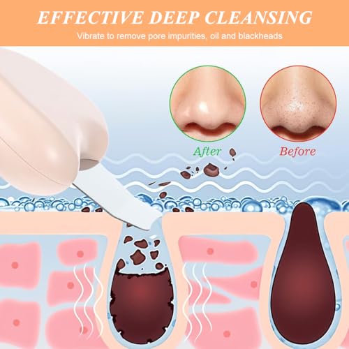 Image of MAYCREATE Black Head Remover Tool for Face, Stainless Steel Blackhead Removal Tool Extractor White Heads Removal Face Scraper with Heart-shaped Handle Curved Facial Skin Scrubber for Deep Cleansing