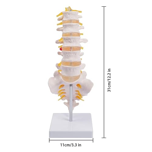 Miniatura 2 de breesky Modelo de columna lumbar - Modelo de anatomía de vértebras lumbares humanas de tamaño real con sacro y nervios espinales Quiropráctico