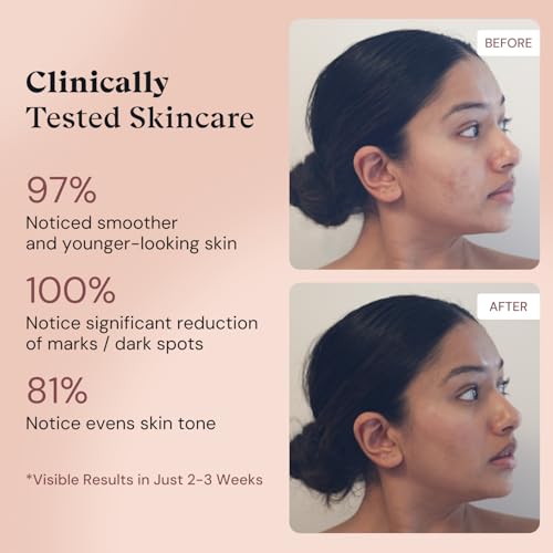 Image of ADM Anti Aging Pure Retinol Serum For Face with Niacinamide - Resurfacing, softer, smoother-looking skin - Moisturizing Facial Skincare for Sensitive Skin - 1oz