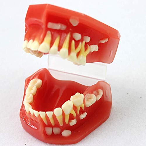 HYCy Teeth Model for Education,Dental Teeth Model-Children Deciduous Dentition Model, Oral Hygiene Model for Entist Teaching Studyingtool