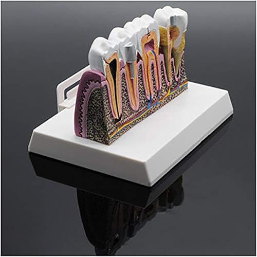Modèle de démonstration de dents buccales avec structures amovibles de précision - 4
