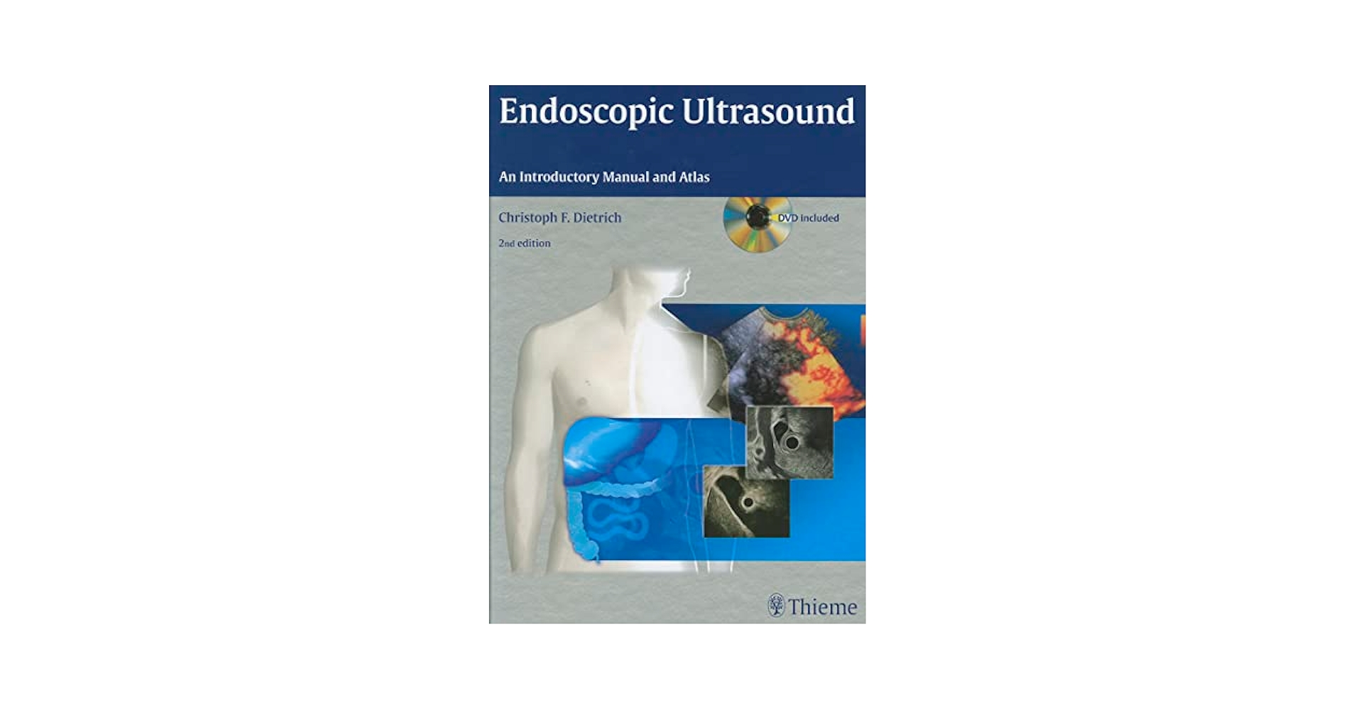 Endoscopic Ultrasound: An Introductory Manual and Atlas