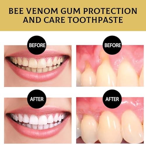 Bienengift Zahnpasta,Bienengift Zahnfleischpflege Zahnpasta Tiefenreinigung Zahnstein Flecken Zahnstein Geruch Frischer Atem Whitening Zahnpasta (2)