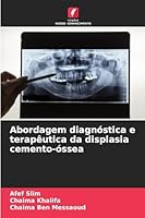 Abordagem diagnóstica e terapêutica da displasia cemento-óssea (Portuguese Edition) 6209022502 Book Cover