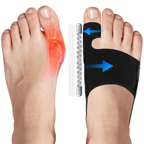 TISMOD 2-Pack Adjustable Bunion Corrector