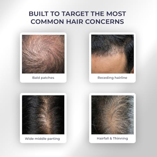 Image of Conscious Chemist Hair Growth & Anti Hair Fall Serum | Hairgenyl, 3% Redensyl, 2% Anagain, 2% Procapil, 2% Biotin & Saw palmetto | Controls Hairfall & 96% Saw New Hair Growth | Improves Hair Density | For Men & Women | 30ml (Pack of 2)