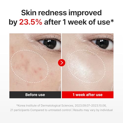 Image of CENTELLIAN 24 Madeca Cream Time Reverse & Active Renew PDRN Duo (2 x 1.69 fl oz) - Firming, Wrinkle care, Elasticity & Hydration with Centella, TECA PDRN & Hyaluronic Acid, Korean moisturizer
