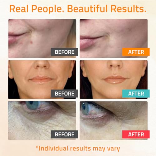 image for YEOUTH Skin Care Set: Retinol Serum for Face, Vitamin C and Hyaluronic