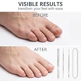 ZEBKEL Profesjonalny zestaw do pedicure do wcielonych paznokci i stóp, 3 sztuki z pilnikiem do paznokci ze stali nierdzewnej, zmywacz do twardych i brudnych narzędzi do manicure z pudełkiem do