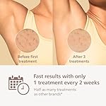 Philips Lumea 8000 Series IPL Hair Removal Device - Permanent Visible Hair Reduction Done at Home, SenseIQ Technology, 2 Attachments for Body & Face, for Women & Men, BRI932/03 - Image 4