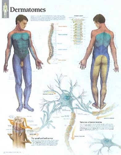 Understanding Dermatomes chart: Wall Chart
