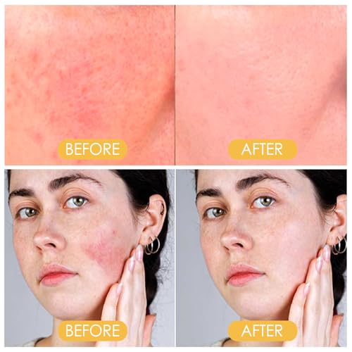 Mrettick Protector Solar Mineral en Polvo SPF 50 PA++ para Cara, Control de Aceite, Acabado Mate Natural, Duradero, Ligero, Transpirable, Translúcido para Toda la Piel - imagen 6