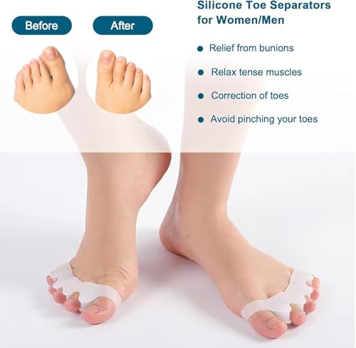 Image of Bunion Corrector Silicone Toe Separators For Fast Pain Relief - Orthopedic Bunion Spacers Spreader Free Size (White AFT)